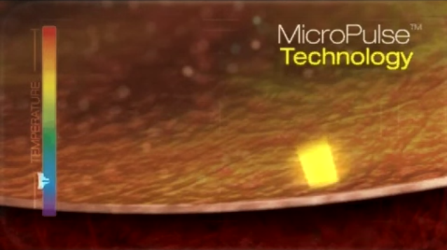Micropulse laser