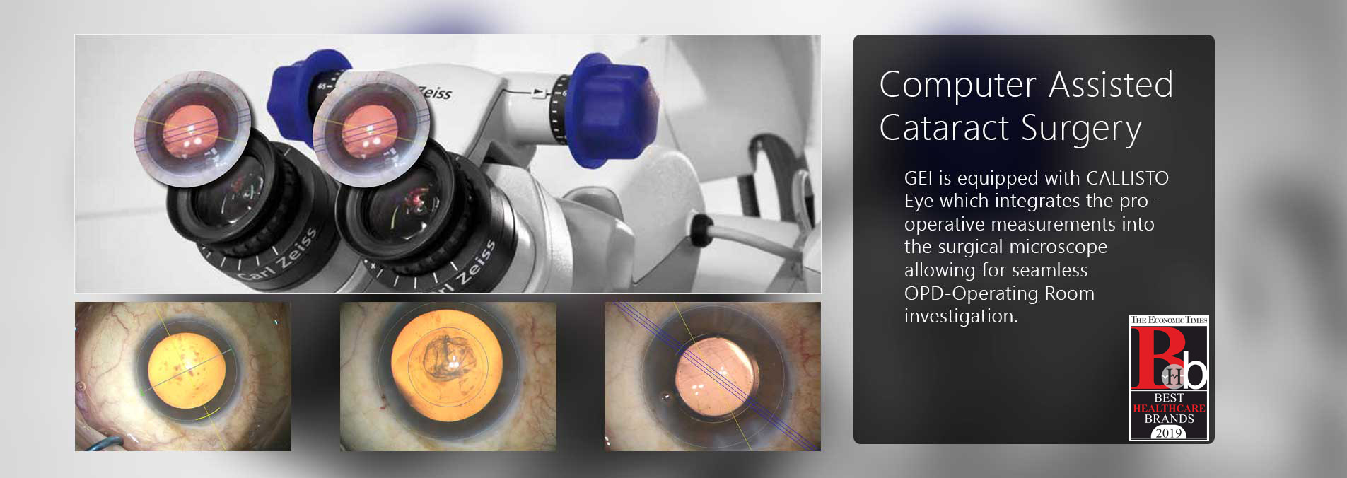 computer assisted cataract surgery